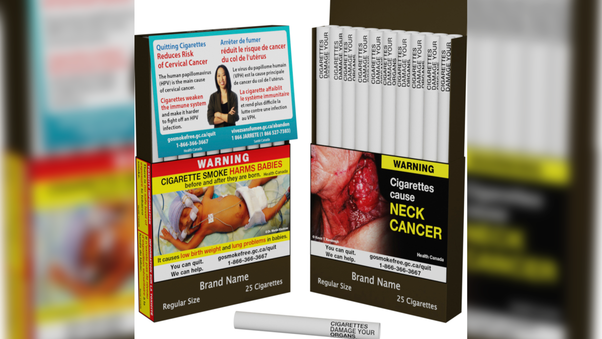 Canada Unveils World's First Individual Cigarette Warning Labels – NBC Bay Area - Vimarsana News