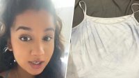 Woman's sweat turned blue during pregnancy: ‘I thought I was becoming an Avatar'