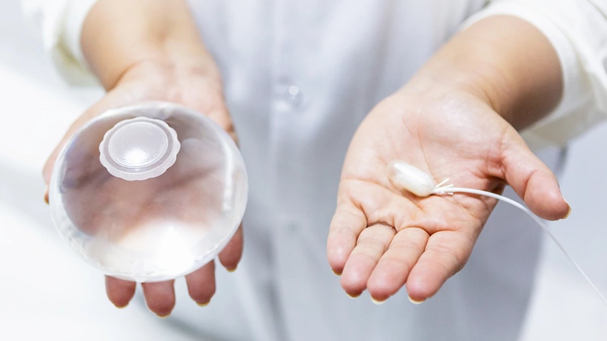 Allurion balloon promises weight loss similar to popular drugs – NBC Bay Area - Vimarsana News