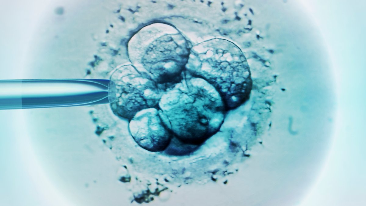 Alabama lawmakers aim to approve immunity laws for IVF providers NBC Bay Area