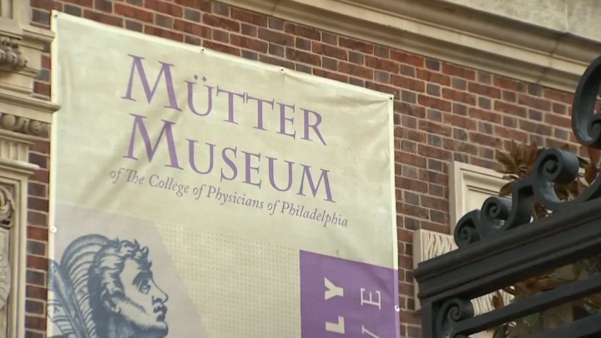 Two preserved fetuses delivered to Mutter Museum in Philly – NBC Bay Area - Vimarsana News