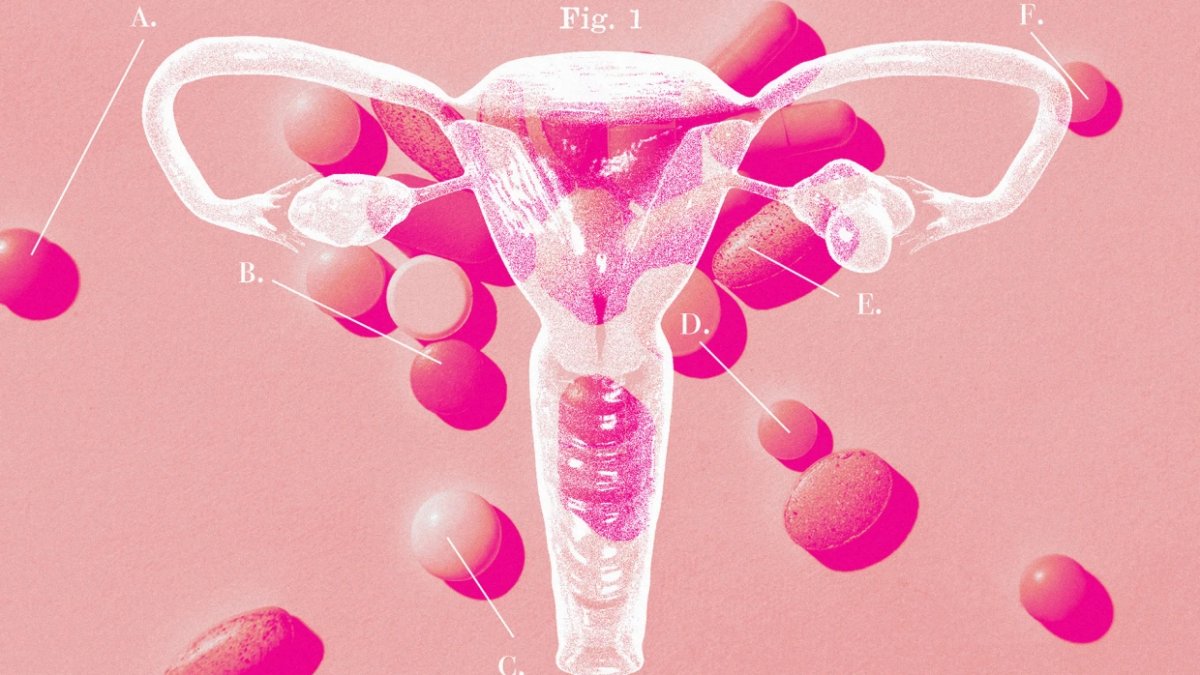 PCOS symptoms are still difficult for doctors to diagnose and treat. Here's why - Vimarsana News