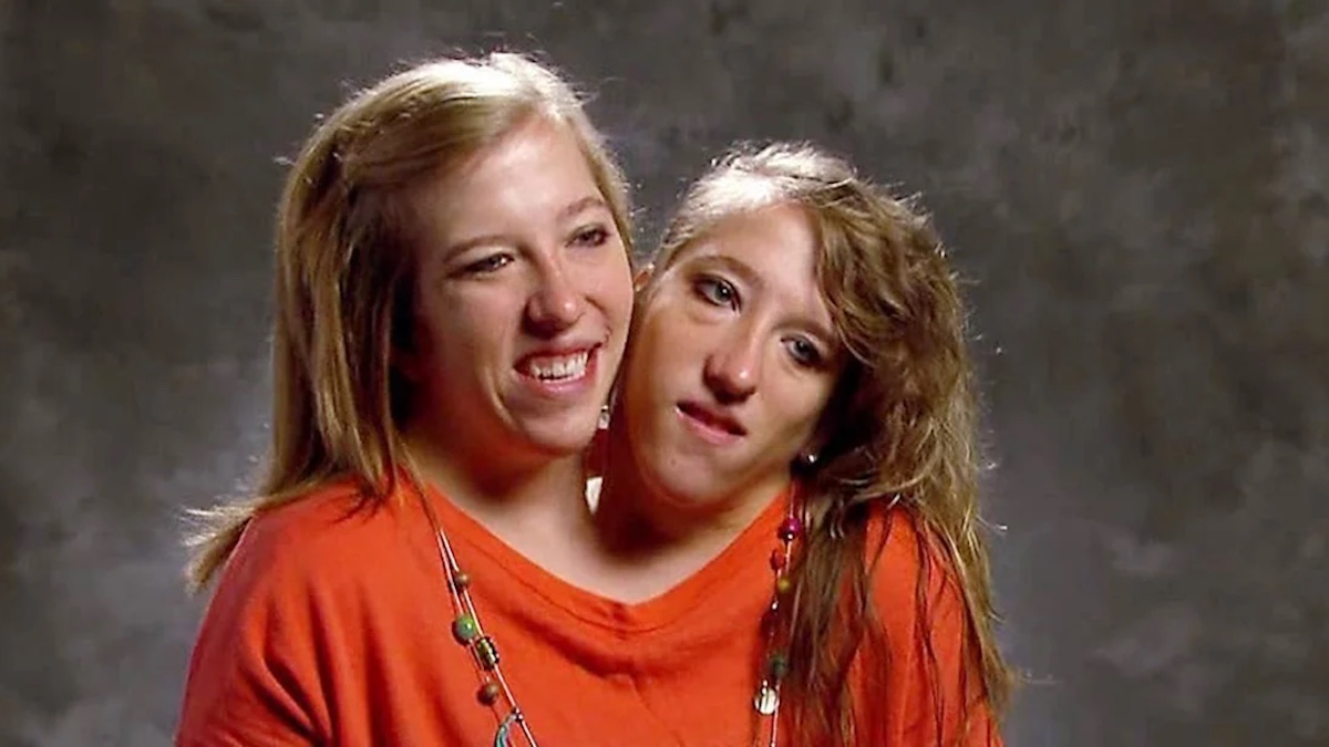 Conjoined twin Abby Hensel is married – NBC Bay Area