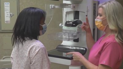 New guidelines say women should be screened every other year for breast cancer starting at 40