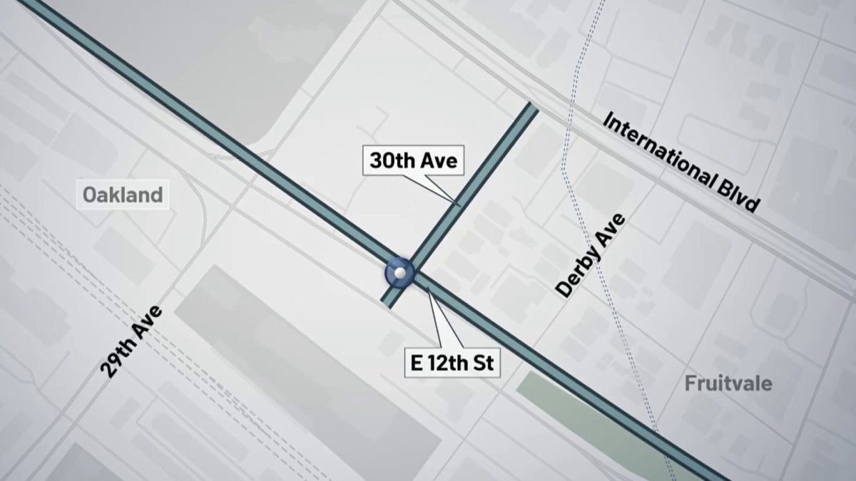 Child hit by car in Oakland – NBC Bay Area