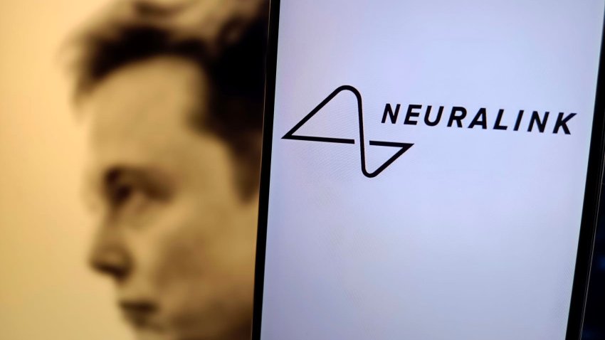 [CNBC] Elon Musk’s Neuralink raises $650 million in fresh capital