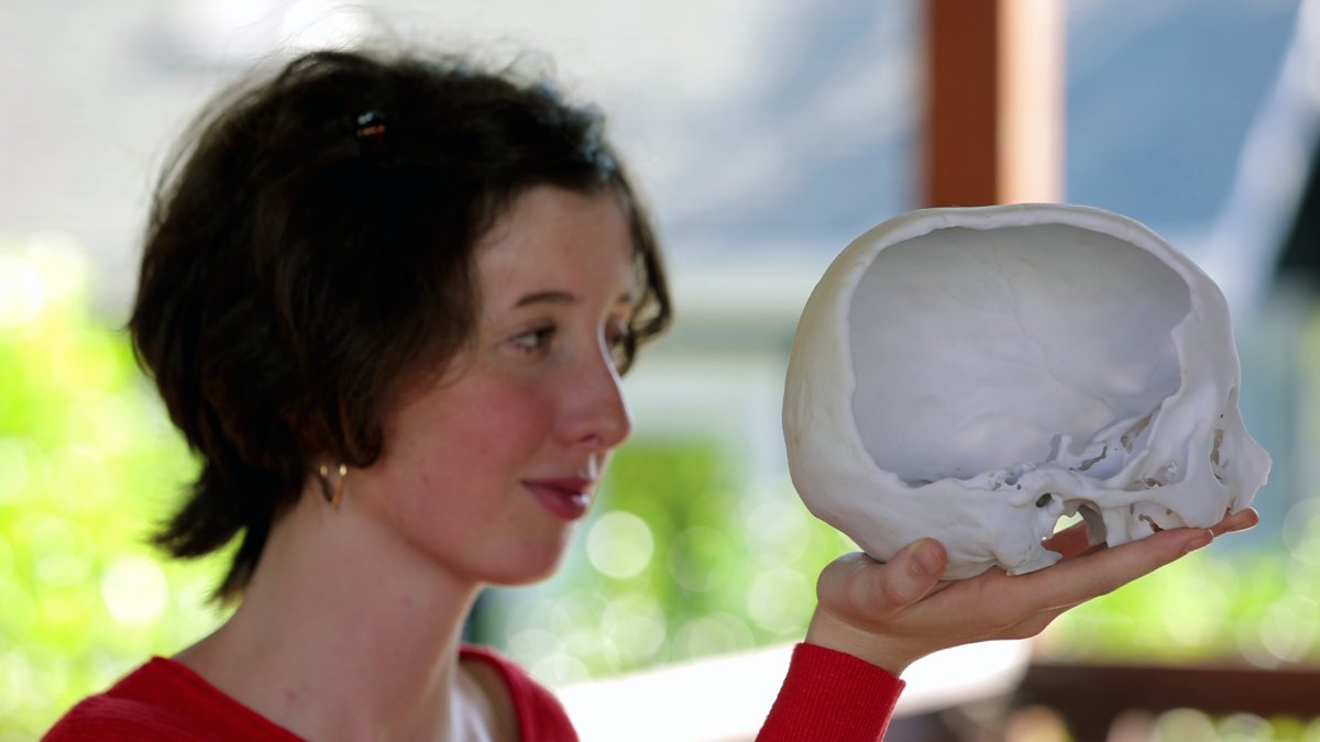 E-bike crash fractured her skull, so California teen set course for reform