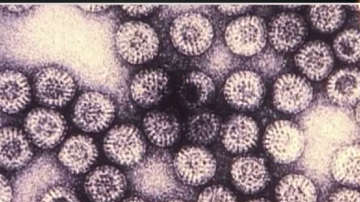 High levels of rotavirus in some Bay Area cities