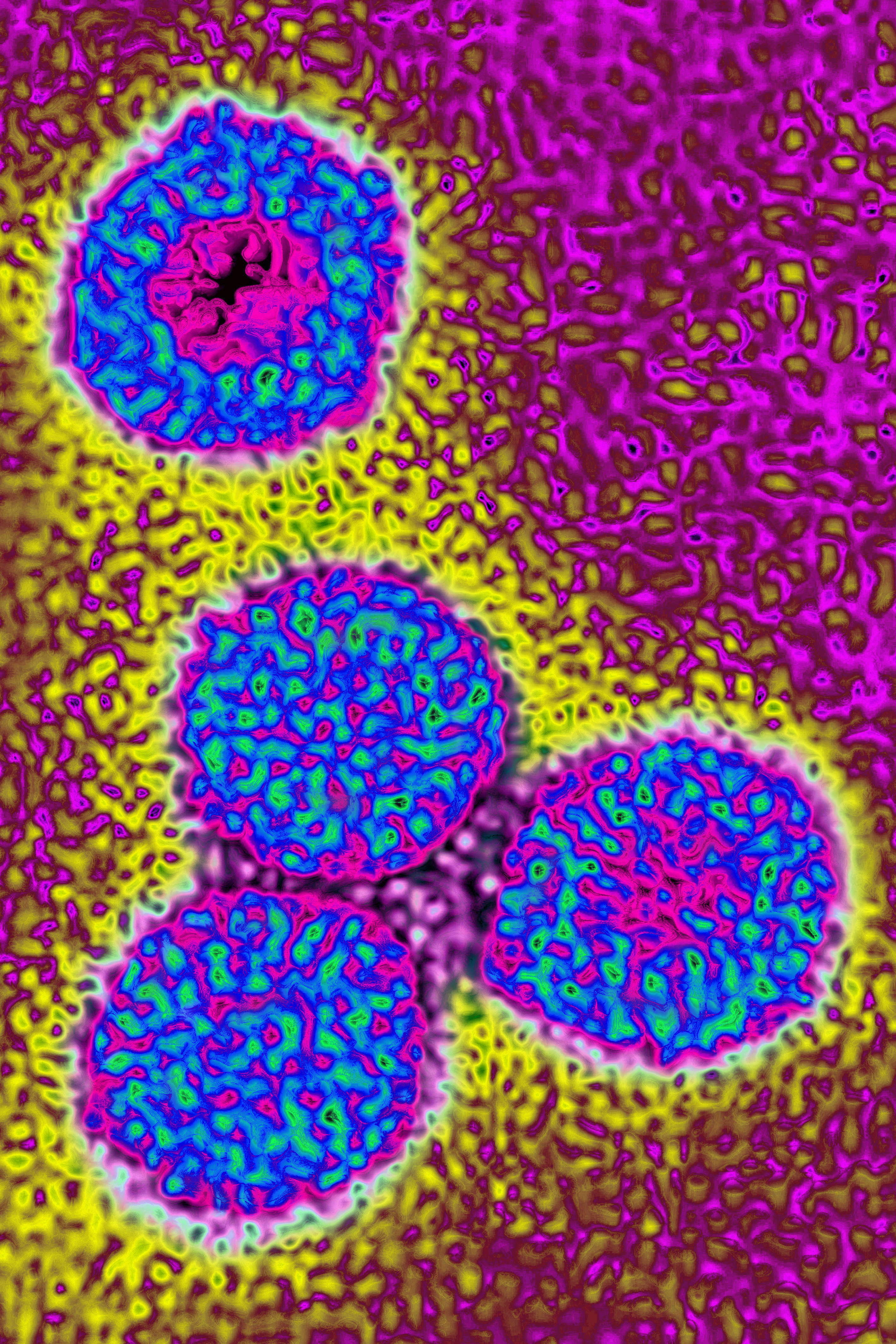 Rotavirus in the Bay Area: How it spreads and how to protect yourself