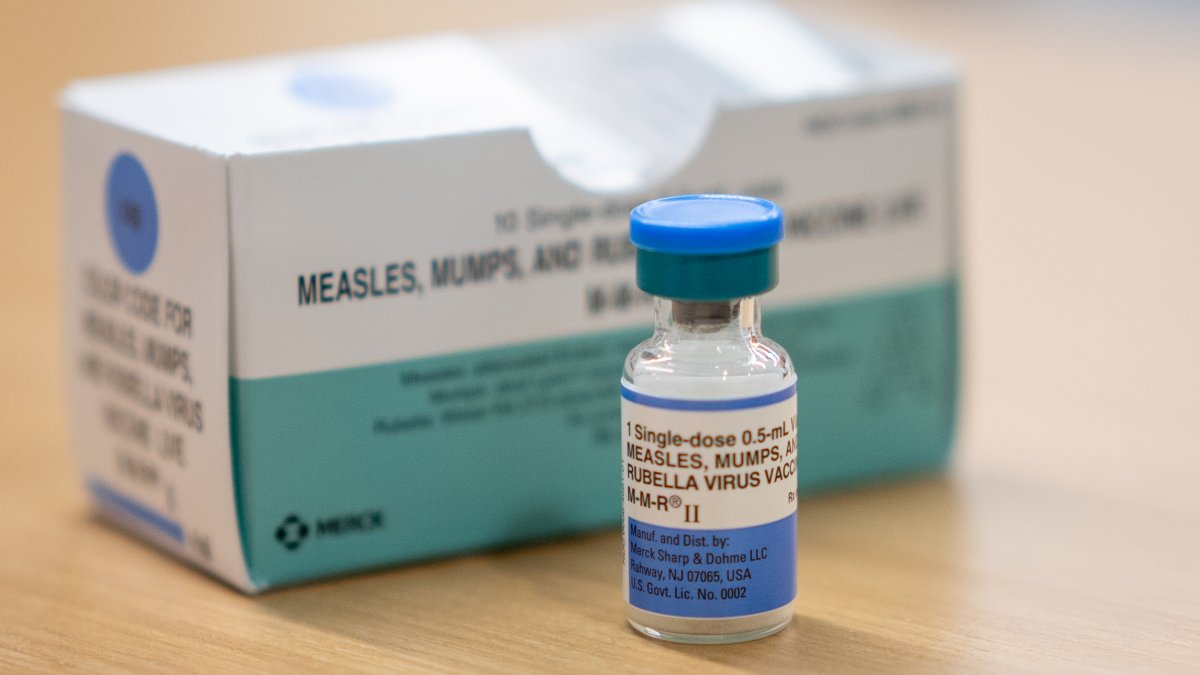 Health officials confirm case of measles in a Santa Clara County resident