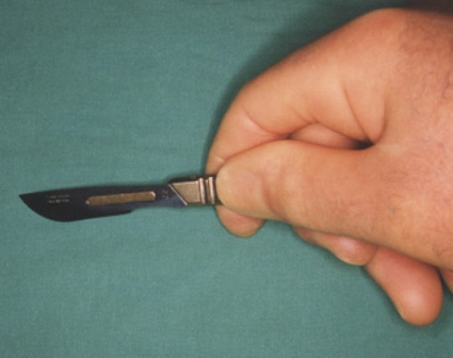 SF May Ban Infant Circumcision